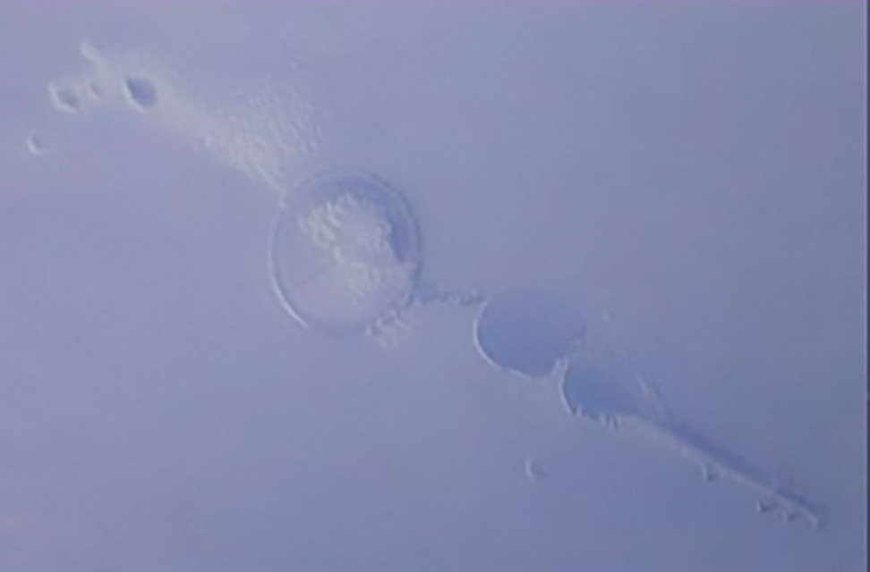360-1-困气：注塑时带入空气